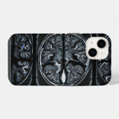 MRI hersenscan iPhone Hoesje (Achterkant horizontaal)