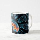 MRI hersenscan Koffiemok (Voorkant rechts)