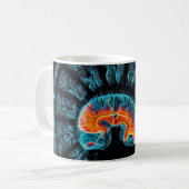 MRI hersenscan Koffiemok (Voorkant links)