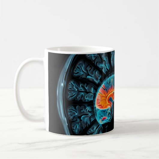 MRI hersenscan Koffiemok (Links)