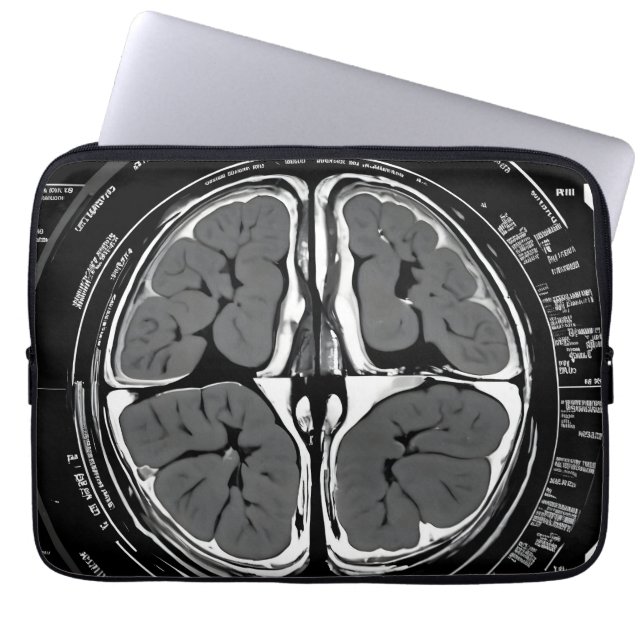 MRI hersenscan Laptop Sleeve (Voorkant)