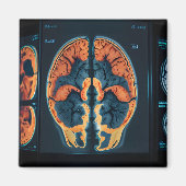 MRI hersenscan Magneet (Voorkant)