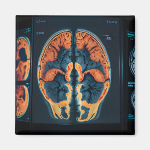 MRI hersenscan Magneet