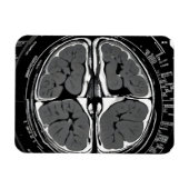 MRI hersenscan Magneet (Horizontaal)