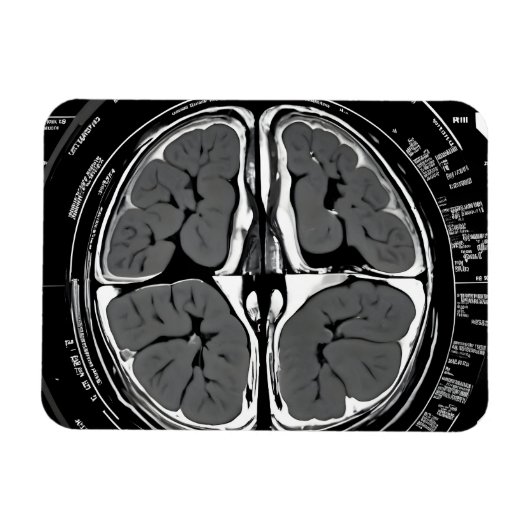 MRI hersenscan Magneet (Horizontaal)