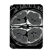 MRI hersenscan Magneet (Verticaal)