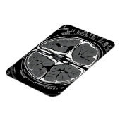 MRI hersenscan Magneet (Linkerzijde)