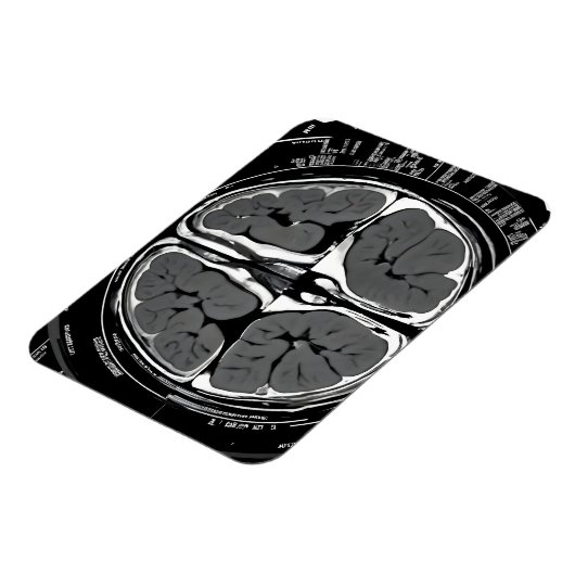 MRI hersenscan Magneet (Linkerzijde)