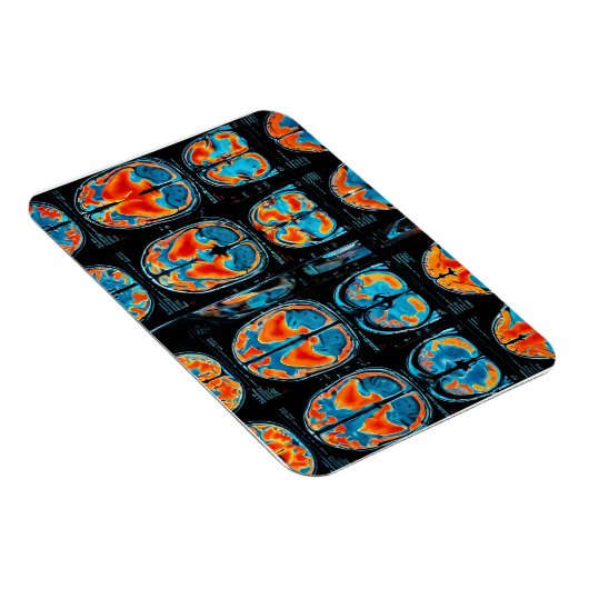 MRI hersenscan Magneet (Rechterzijde)