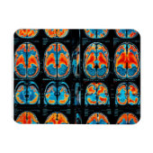 MRI hersenscan Magneet (Horizontaal)