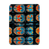 MRI hersenscan Magneet (Verticaal)