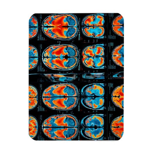 MRI hersenscan Magneet (Verticaal)