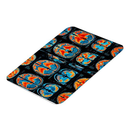 MRI hersenscan Magneet (Linkerzijde)