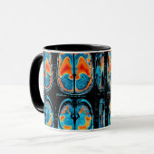 MRI hersenscan Mok (Voorkant links)