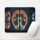 MRI-hersenscan Muismat (Met muis)