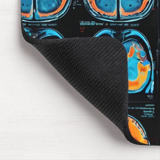 MRI hersenscan Muismat (Hoek)