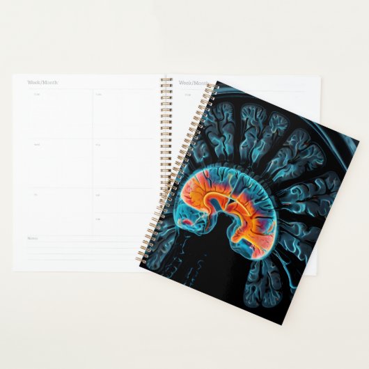 MRI hersenscan Planner (Display)