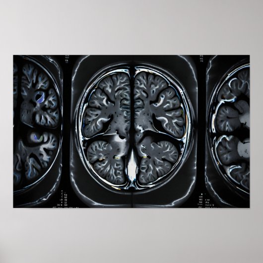MRI hersenscan Poster (Voorkant)