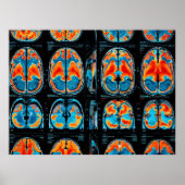MRI hersenscan Poster (Voorkant)