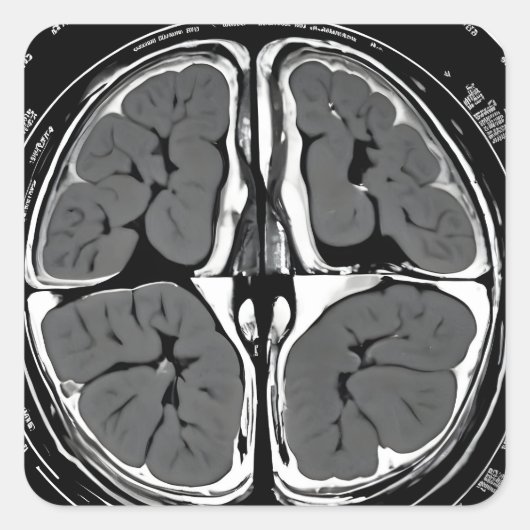 MRI hersenscan Vierkante Sticker (Voorkant)