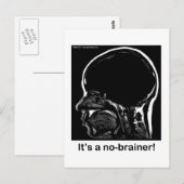 MRI: Het is een niet-hersenbreker! Briefkaart (Voorkant / Achterkant)