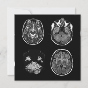 MRI-scan van Brain