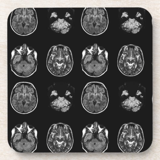 MRI-scan van Brain Bier Onderzetter (Voorkant)