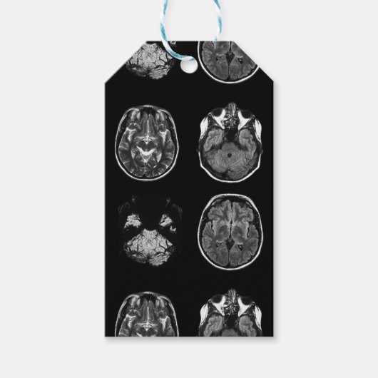 MRI-scan van Brain Cadeaulabel (Voorkant)