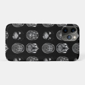 MRI-scan van Brain Case-Mate iPhone Case (Achterkant (horizontaal))