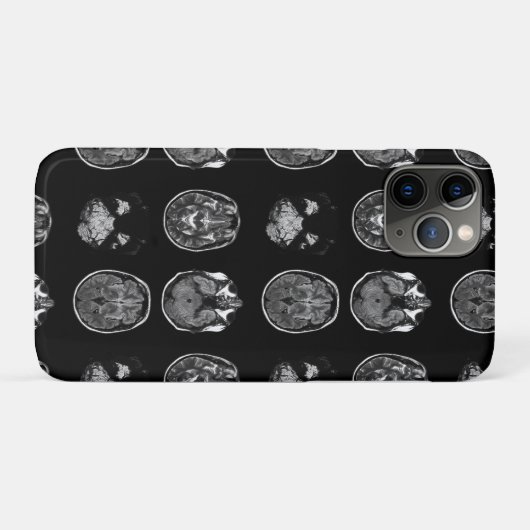MRI-scan van Brain Case-Mate iPhone Case (Achterkant (horizontaal))