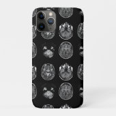 MRI-scan van Brain Case-Mate iPhone Case (Achterkant)