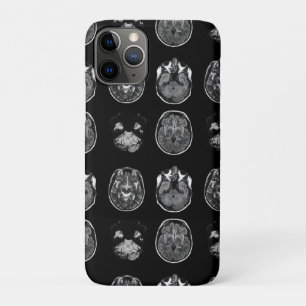 MRI-scan van Brain Case-Mate iPhone Case