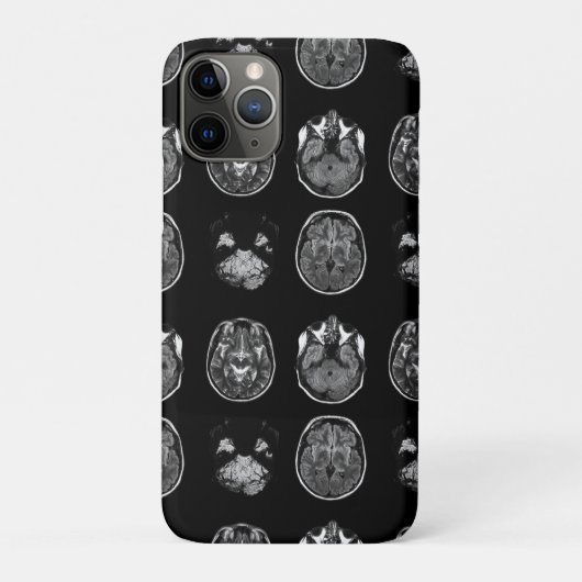 MRI-scan van Brain Case-Mate iPhone Case (Achterkant)