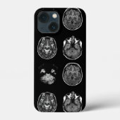 MRI-scan van Brain Case-Mate iPhone Case (Achterkant)