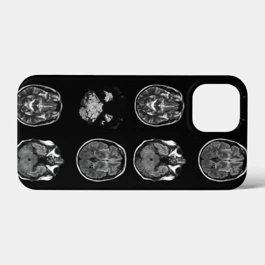 MRI-scan van Brain Case-Mate iPhone Case (Achterkant (horizontaal))