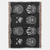 MRI-scan van Brain Deken (Voorkant Verticaal)