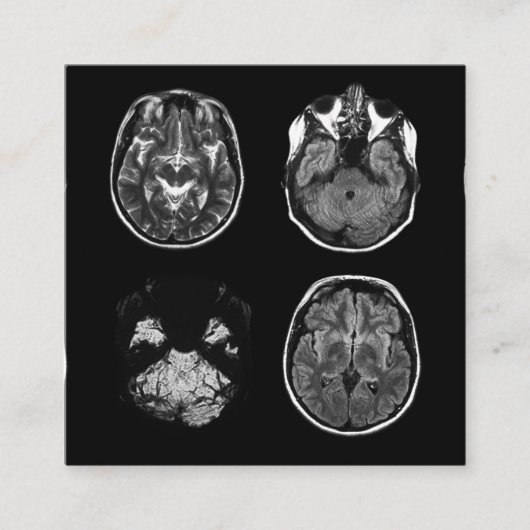 MRI-scan van Brain Informatiekaartje (Voorkant)
