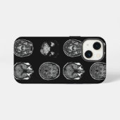 MRI-scan van Brain iPhone Hoesje (Achterkant horizontaal)