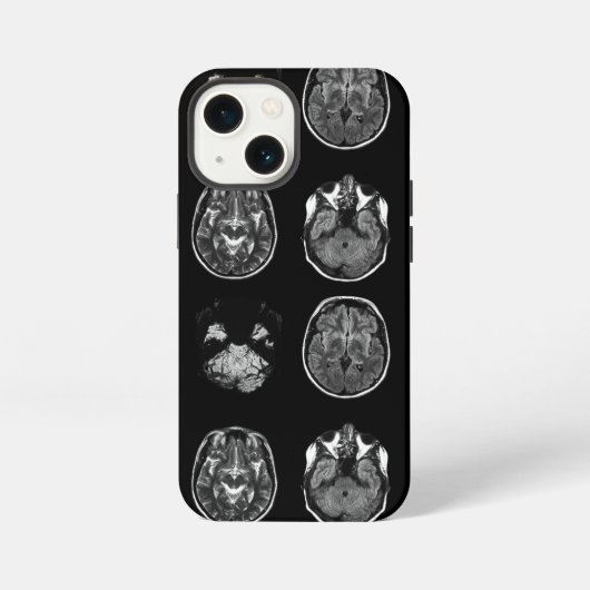MRI-scan van Brain iPhone Hoesje (Achterkant)