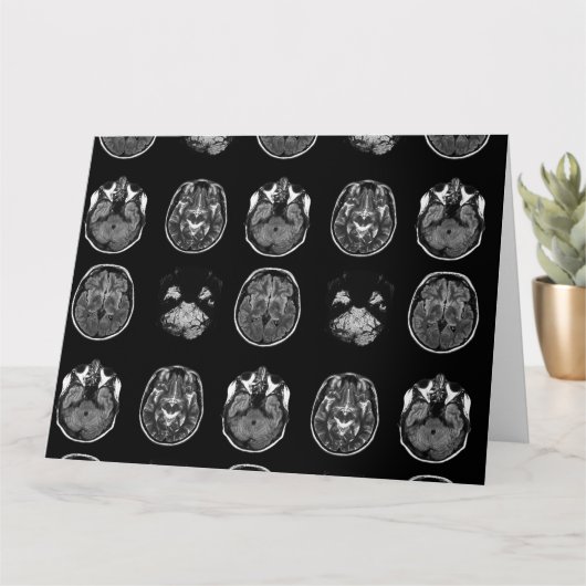 MRI-scan van Brain Kaart (Kleine Plant)