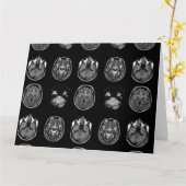 MRI-scan van Brain Kaart (Gele Bloem)