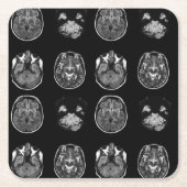 MRI-scan van Brain Kartonnen Onderzetters (Voorkant)