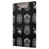 MRI-scan van Brain Klembord (Links)