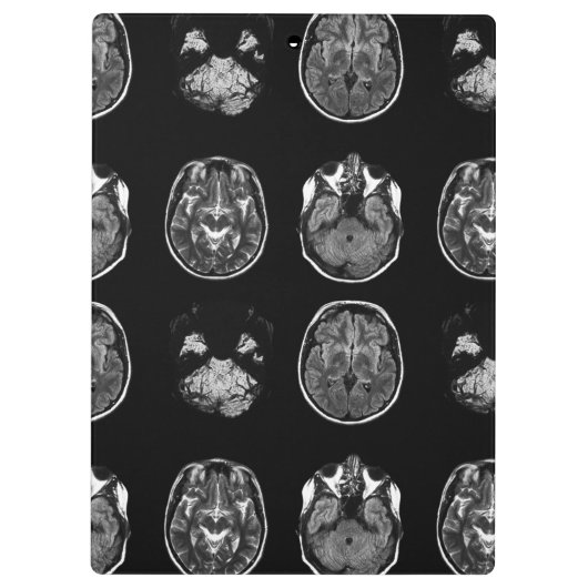 MRI-scan van Brain Klembord (Achterkant)