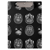MRI-scan van Brain Klembord (Voorkant)