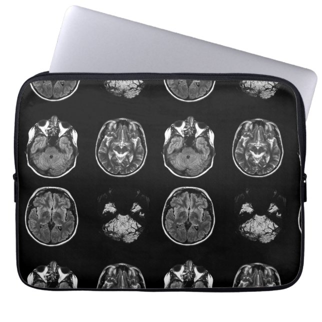 MRI-scan van Brain Laptop Sleeve (Voorkant)