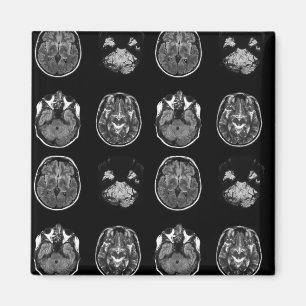 MRI-scan van Brain Magneet