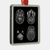 MRI-scan van Brain Metalen Ornament (Rechts)