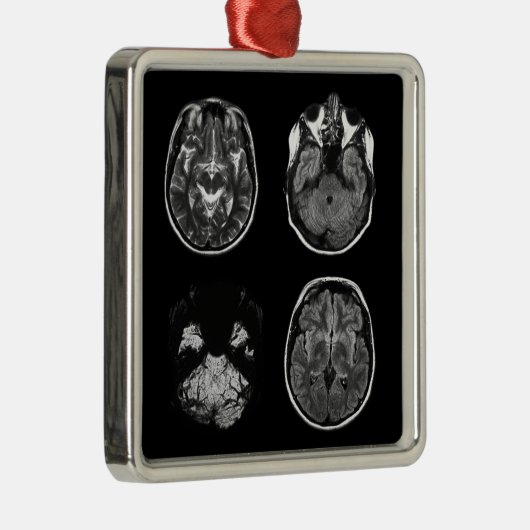 MRI-scan van Brain Metalen Ornament (Rechts)