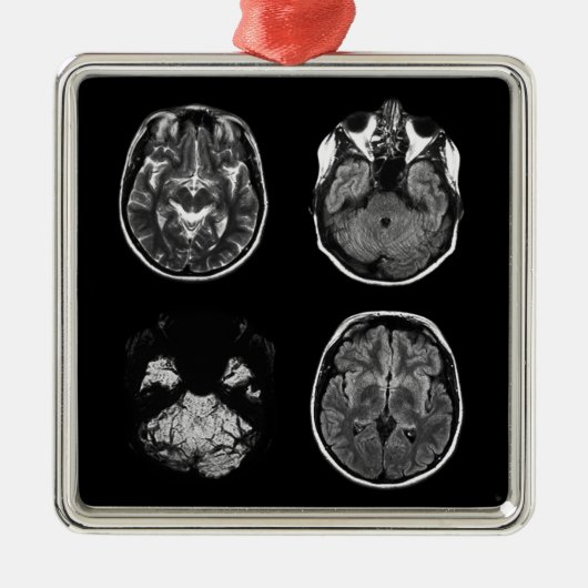 MRI-scan van Brain Metalen Ornament (Voorkant)
